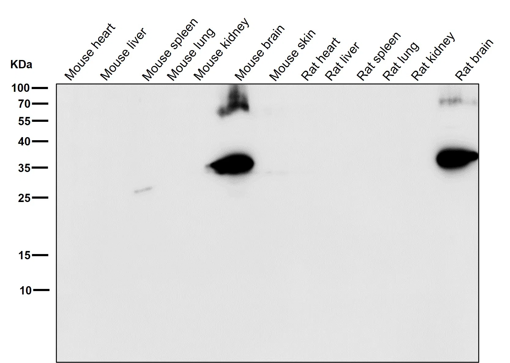 Syntaxin Rabbit Monoclonal Antibody - Size: 100µl