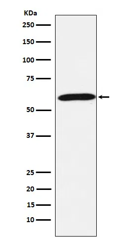 Calsequestrin 1 Rabbit Monoclonal Antibody - Size: 50µl