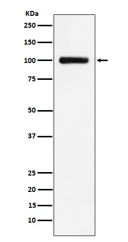 Transferrin Receptor 2 Rabbit Monoclonal Antibody
