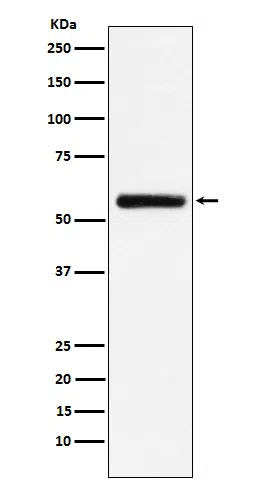 STK33 Rabbit Monoclonal Antibody - Size: 100µl