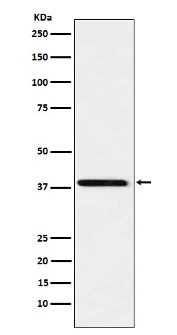 SAE1 Rabbit Monoclonal Antibody