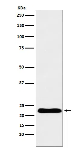 TNNI1 Rabbit Monoclonal Antibody - Size: 100µl
