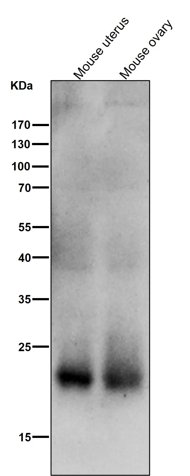 SOCS2 Rabbit Monoclonal Antibody - Size: 100µl