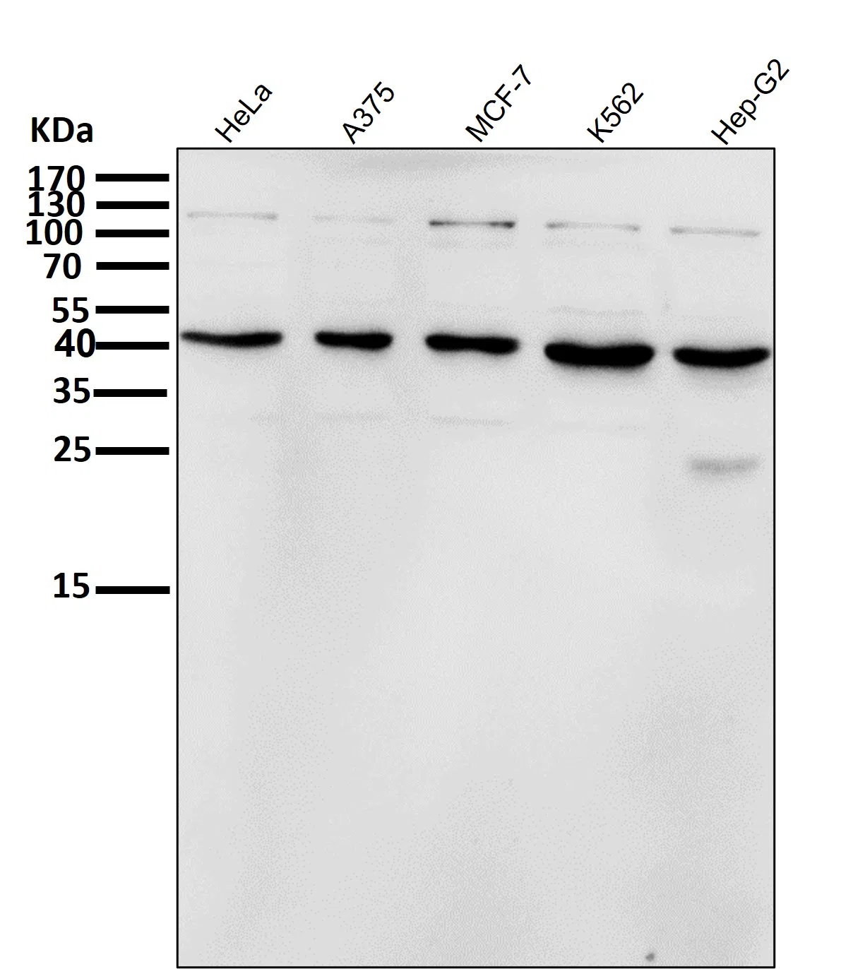 Inhibin beta A Rabbit Monoclonal Antibody - Size: 100µl