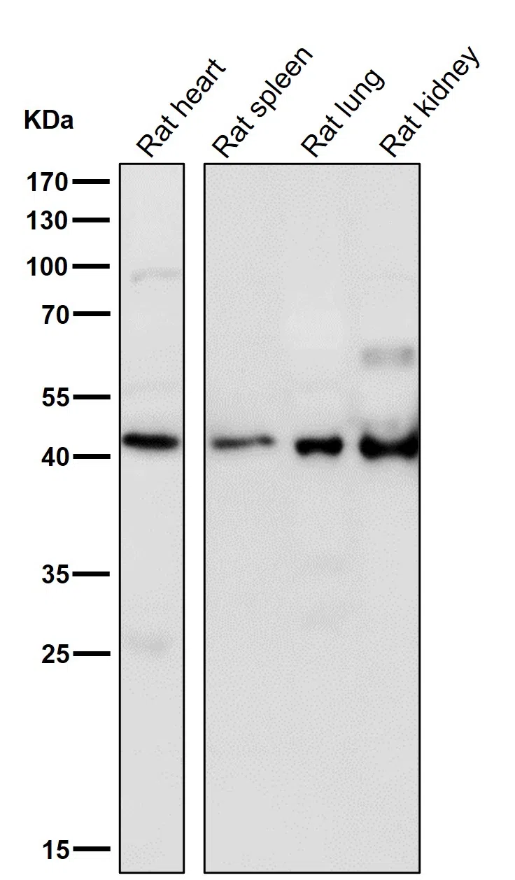 HOXA5 Rabbit Monoclonal Antibody - Size: 50µl