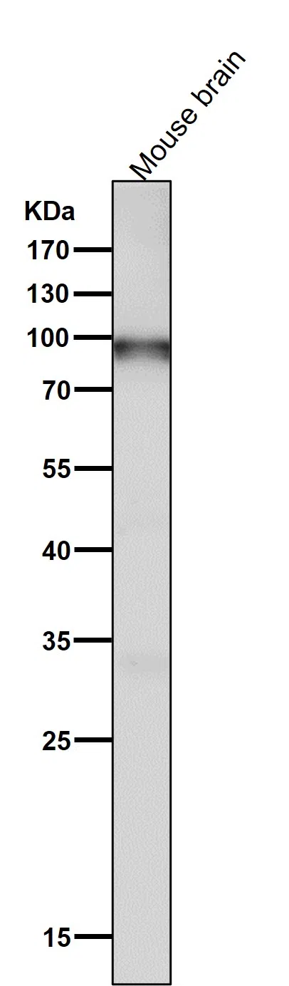 UBF1 Rabbit Monoclonal Antibody - Size: 50µl