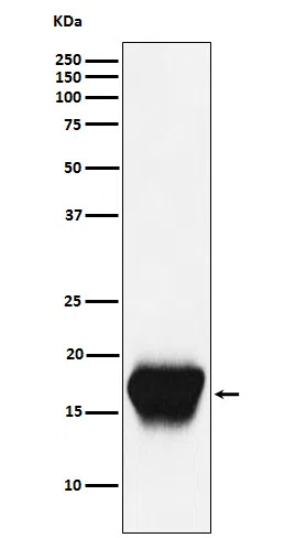 CD52 Rabbit Monoclonal Antibody - Size: 50µl