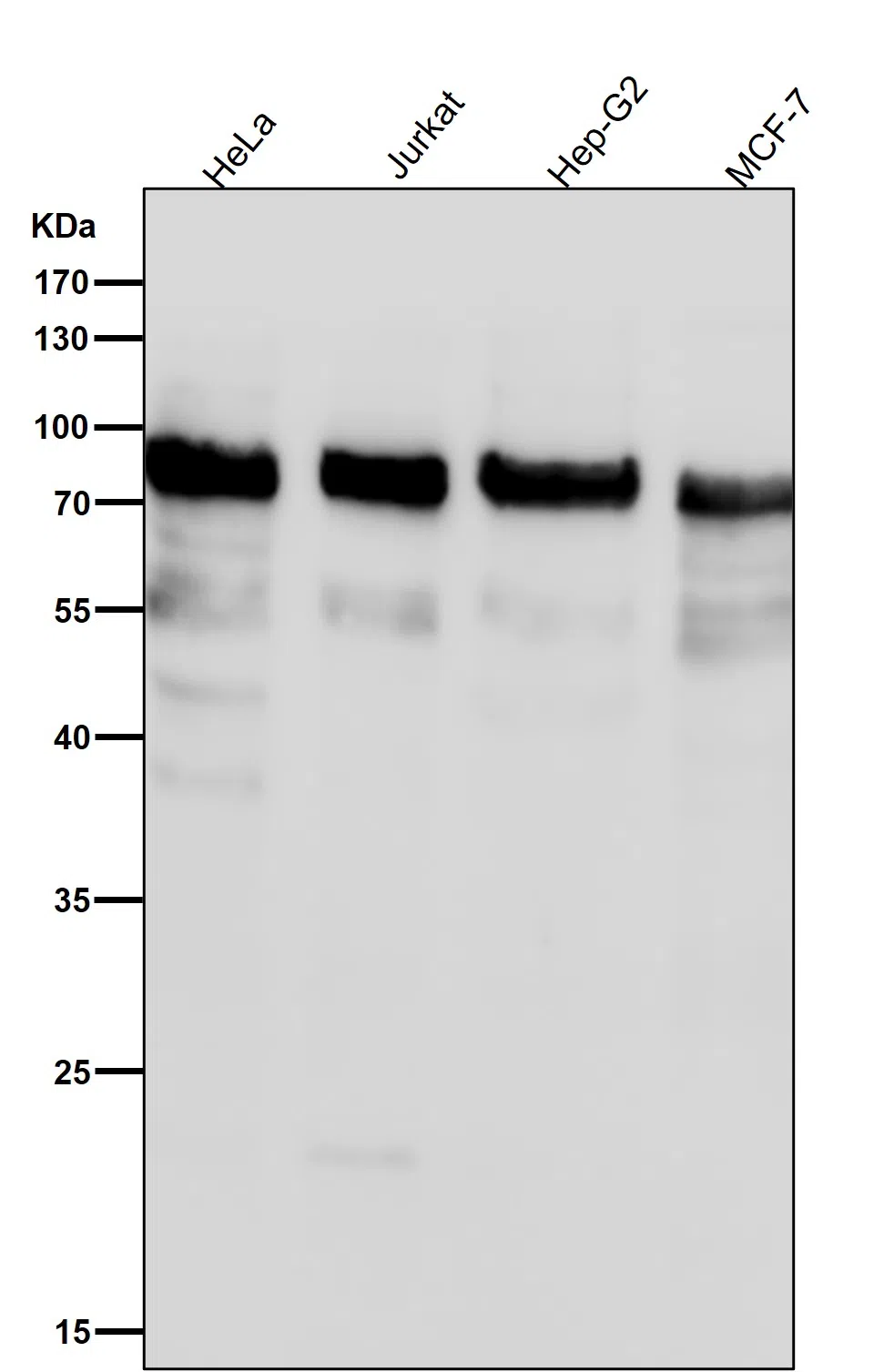 Phospho-UBF1(S484) Rabbit Monoclonal Antibody - Size: 50µl