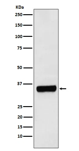 PRKRA Rabbit Monoclonal Antibody - Size: 100µl