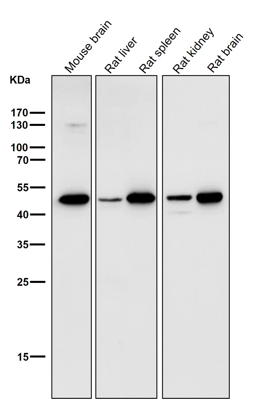 LIS1 Rabbit Monoclonal Antibody - Size: 50µl