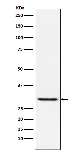 TIRAP Rabbit Monoclonal Antibody - Size: 50µl