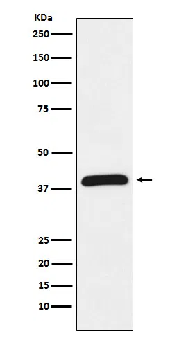 HIF1AN Rabbit Monoclonal Antibody - Size: 50µl