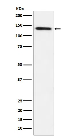 Lipin1 Rabbit Monoclonal Antibody - Size: 100µl
