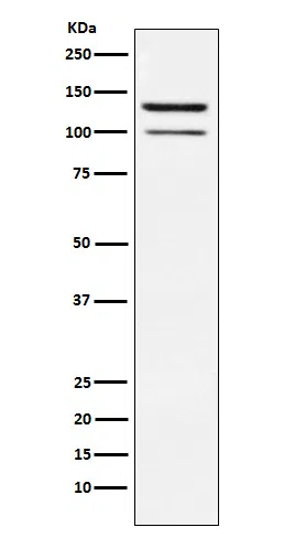 HIPK2 Rabbit Monoclonal Antibody - Size: 100µl