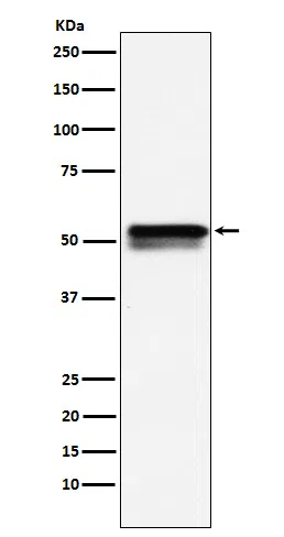 EGR2 Rabbit Monoclonal Antibody - Size: 50µl