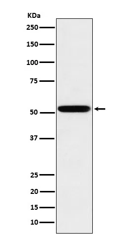 Human IgG2 Rabbit Monoclonal Antibody - Size: 50µl