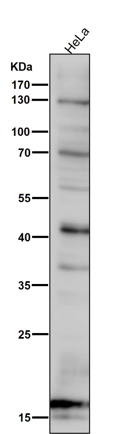 SDHC Rabbit Monoclonal Antibody - Size: 100µl