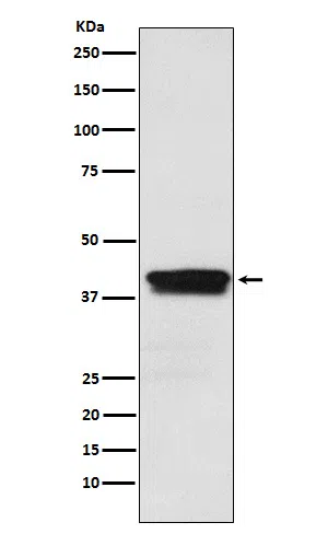MBNL1 Rabbit Monoclonal Antibody - Size: 50µl
