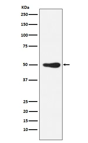 FOXL2 Rabbit Monoclonal Antibody - Size: 100µl