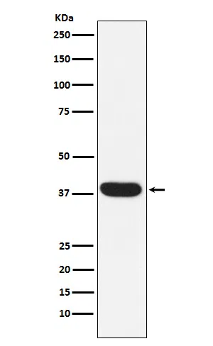 MYF5 Rabbit Monoclonal Antibody - Size: 50µl