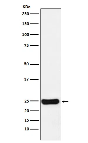 Cathepsin S Rabbit Monoclonal Antibody - Size: 100µl