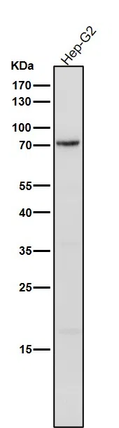 Phospho-PKC delta(Y311) Rabbit Monoclonal Antibody - Size: 100µl
