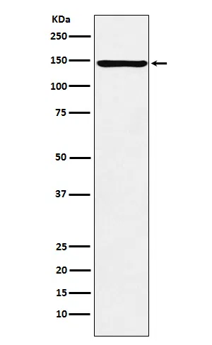ORP150 Rabbit Monoclonal Antibody