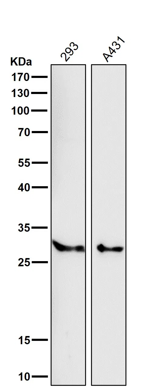 SRD5A2 Rabbit Monoclonal Antibody - Size: 100µl