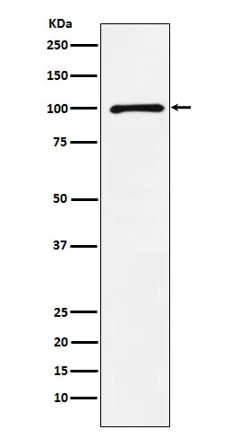 GRIK2 Rabbit Monoclonal Antibody - Size: 50µl