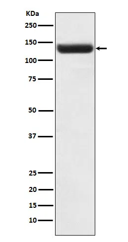 ZNF217 Rabbit Monoclonal Antibody - Size: 50µl