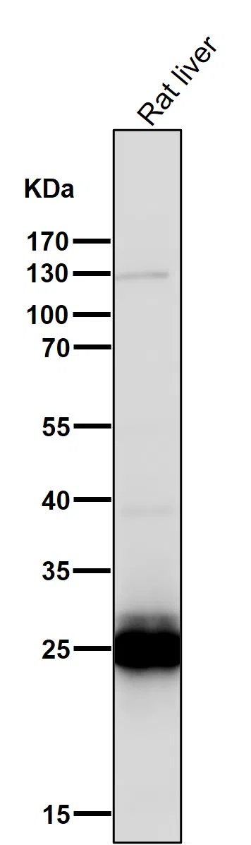 COMT Rabbit Monoclonal Antibody - Size: 100µl