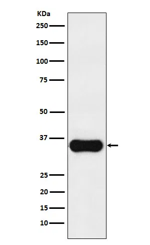MC1R eceptor Rabbit Monoclonal Antibody - Size: 100µl