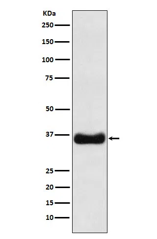 Olig1 Rabbit Monoclonal Antibody - Size: 50µl