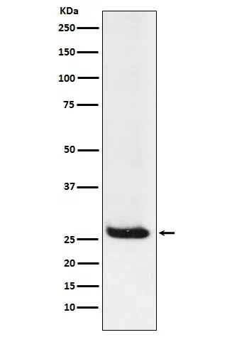 Hippocalcin Rabbit Monoclonal Antibody