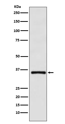 DMRT1 Rabbit Monoclonal Antibody - Size: 50µl