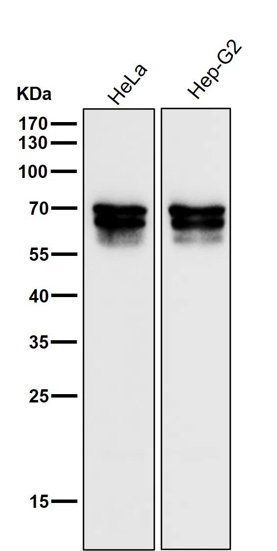 PICALM Rabbit Monoclonal Antibody