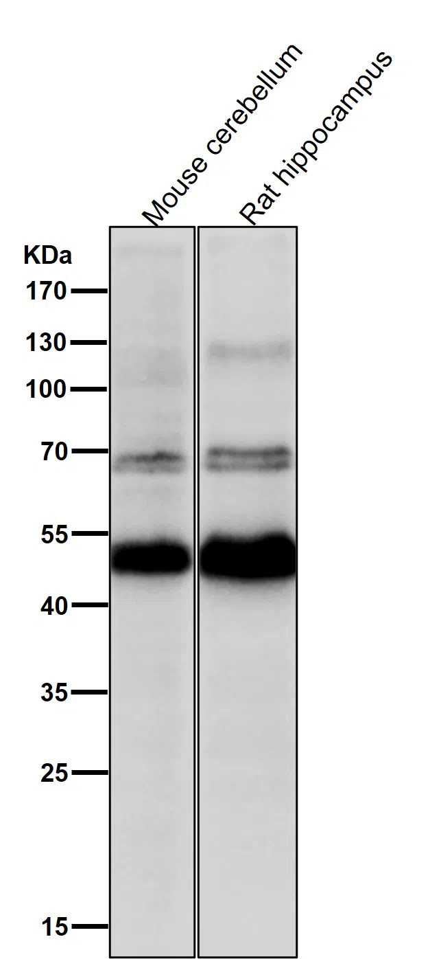 CHX10 Rabbit Monoclonal Antibody - Size: 100µl