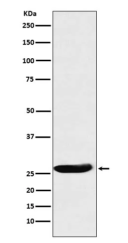 CLPP Rabbit Monoclonal Antibody - Size: 100µl