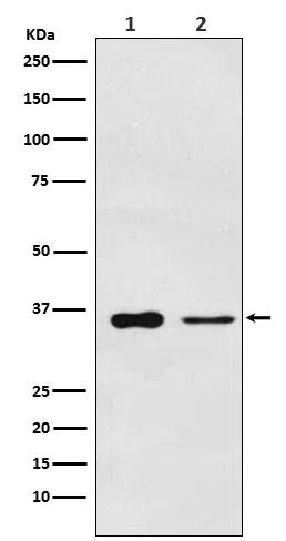 PDLIM1 Rabbit Monoclonal Antibody - Size: 100µl