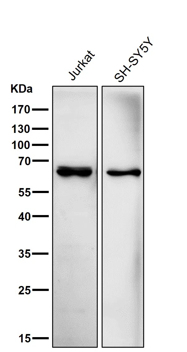 ACADVL/VLCAD Rabbit Monoclonal Antibody - Size: 50µl