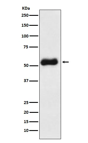 Thromboxane synthase Rabbit Monoclonal Antibody