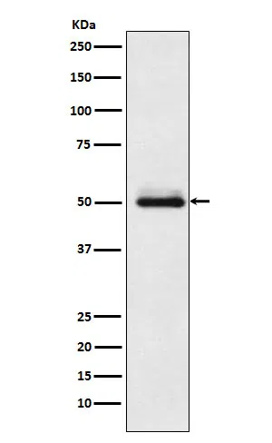 Cytochrome P450 2C9 Rabbit Monoclonal Antibody - Size: 50µl