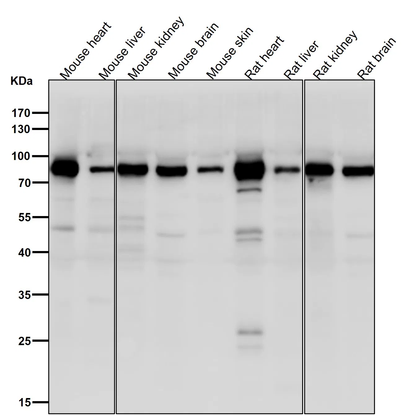 ACVR2A Rabbit Monoclonal Antibody - Size: 50µl