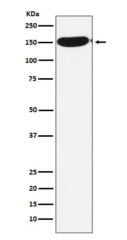 CPS1 Rabbit Monoclonal Antibody