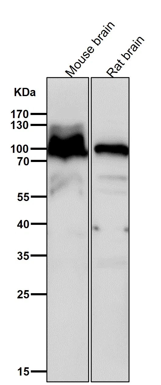 Alpha 1 adaptin Rabbit Monoclonal Antibody - Size: 100µl