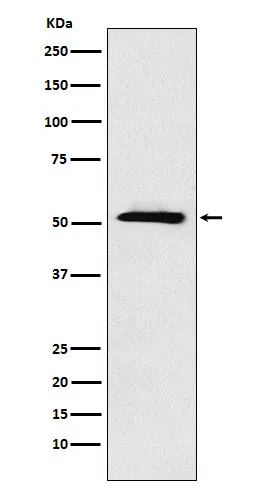 ETV6 Rabbit Monoclonal Antibody - Size: 100µl