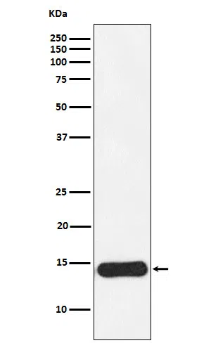 CRABP1 Rabbit Monoclonal Antibody - Size: 50µl