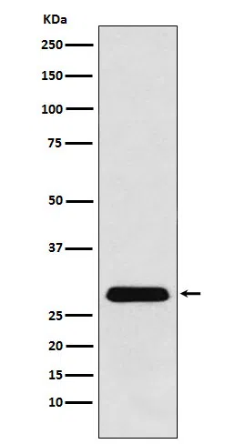 PGAM1 Rabbit Monoclonal Antibody - Size: 100µl