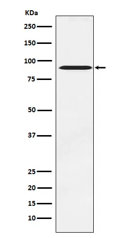 ATRIP Rabbit Monoclonal Antibody