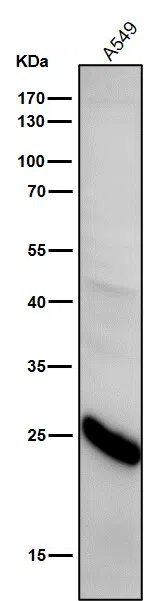 Glutathione Peroxidase 2 Rabbit Monoclonal Antibody - Size: 50µl